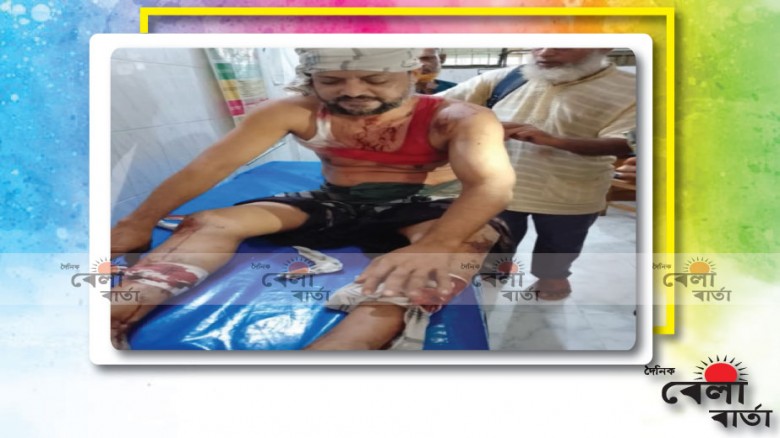 " সন্দেহকারীদের হামলায় আহত ০১ , মুমূর্ষ অবস্থায় হাসপাতালে ভর্তি "